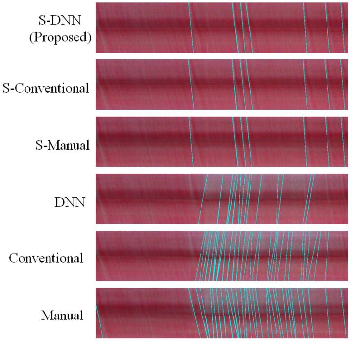 https://cdn.ncbi.nlm.nih.gov/pmc/blobs/841e/7763965/541dc3d81960/sensors-20-07101-g0A4.jpg