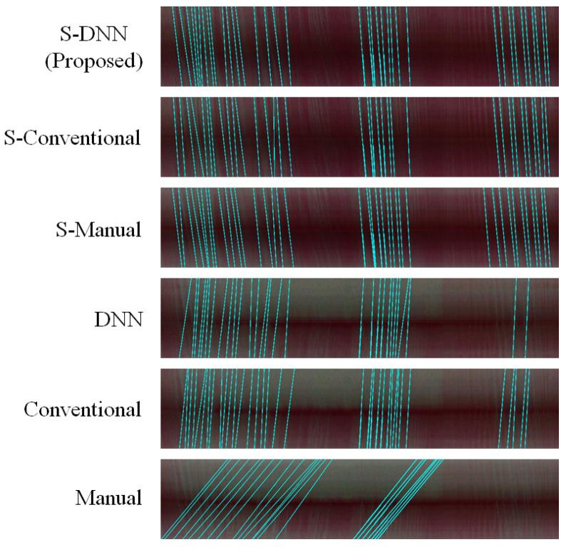 https://cdn.ncbi.nlm.nih.gov/pmc/blobs/841e/7763965/aae222e913d3/sensors-20-07101-g0A1.jpg