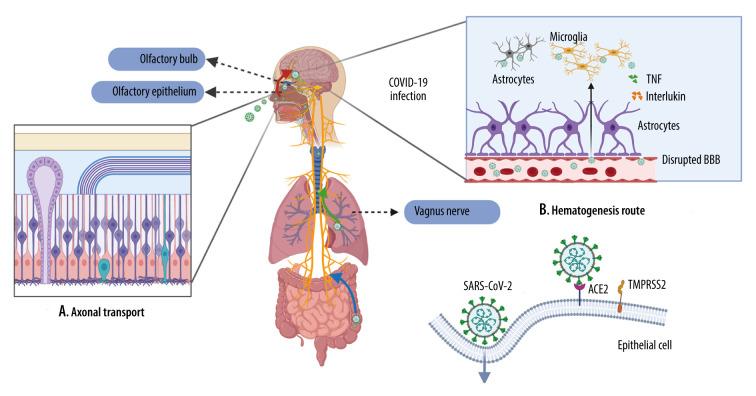https://cdn.ncbi.nlm.nih.gov/pmc/blobs/841f/8221270/70677c11f336/medscimonit-27-e932962-g001.jpg