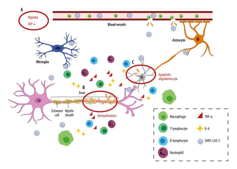 https://cdn.ncbi.nlm.nih.gov/pmc/blobs/841f/8221270/f3d393412064/medscimonit-27-e932962-g002.jpg