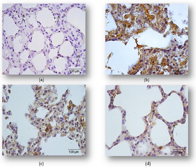 https://cdn.ncbi.nlm.nih.gov/pmc/blobs/8425/8910433/95693e8ad7f2/ijms-23-02596-g002.jpg