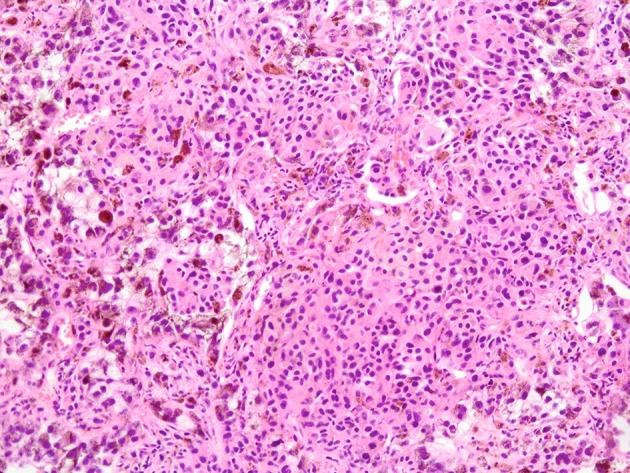 https://cdn.ncbi.nlm.nih.gov/pmc/blobs/8429/5624695/abd554d7a1b3/wjon-07-040-g008.jpg