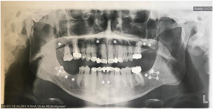 https://cdn.ncbi.nlm.nih.gov/pmc/blobs/8432/10107344/45bc2c8279da/GCC-62-210-g004.jpg