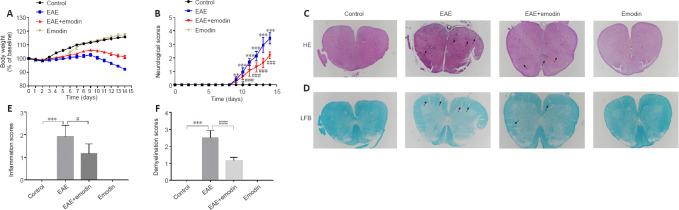 https://cdn.ncbi.nlm.nih.gov/pmc/blobs/843c/10075100/49b67155a592/NRR-18-1535-g002.jpg
