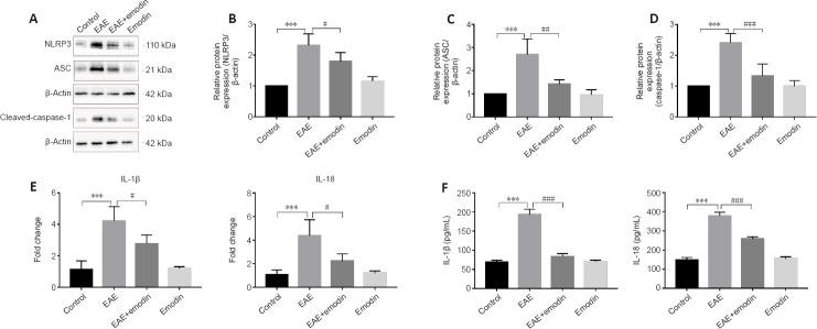 https://cdn.ncbi.nlm.nih.gov/pmc/blobs/843c/10075100/6da7932beac0/NRR-18-1535-g005.jpg