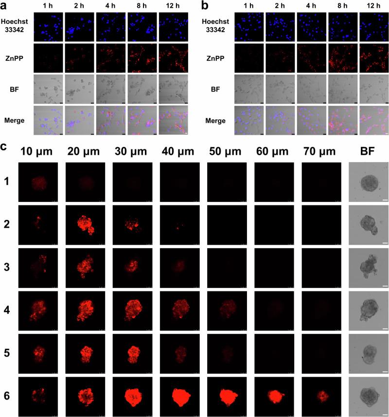 https://cdn.ncbi.nlm.nih.gov/pmc/blobs/8441/11704041/a6c6229c9a3c/41467_2024_55658_Fig3_HTML.jpg