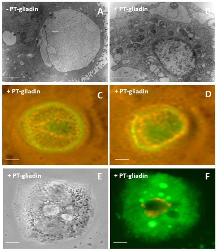 https://cdn.ncbi.nlm.nih.gov/pmc/blobs/8446/5855857/5c8d5b06105b/ijms-19-00635-g005.jpg