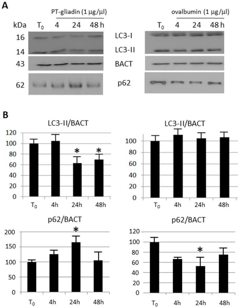 https://cdn.ncbi.nlm.nih.gov/pmc/blobs/8446/5855857/99298939f17a/ijms-19-00635-g009.jpg