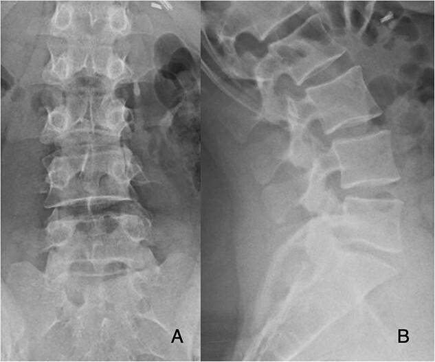 https://cdn.ncbi.nlm.nih.gov/pmc/blobs/8447/10276951/15c1f9f28ce7/rjad341f1.jpg