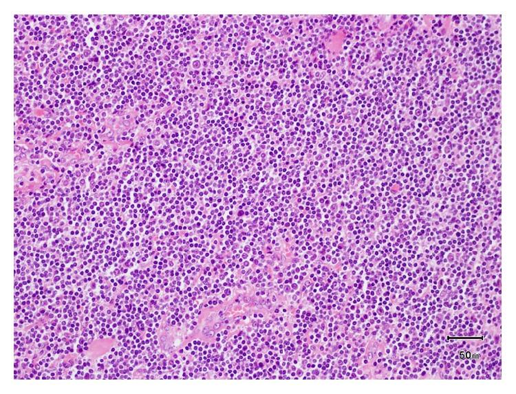 https://cdn.ncbi.nlm.nih.gov/pmc/blobs/8447/4637478/3049237c2a1c/CRIS2015-813708.003.jpg