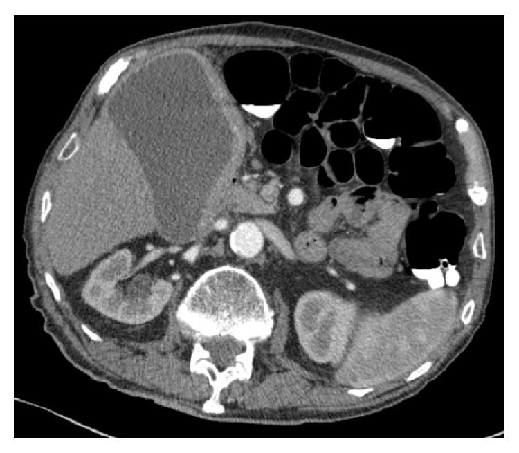 https://cdn.ncbi.nlm.nih.gov/pmc/blobs/8447/4637478/bfc201bf5c93/CRIS2015-813708.001.jpg