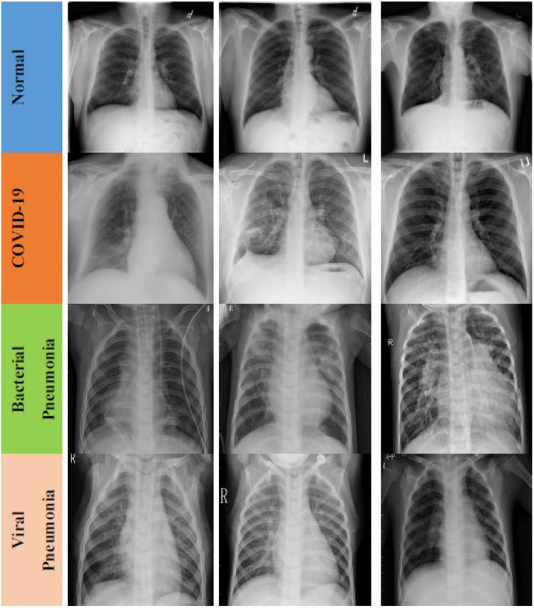 https://cdn.ncbi.nlm.nih.gov/pmc/blobs/8447/8106971/d510c3638681/10044_2021_984_Fig1_HTML.jpg