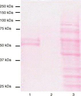 https://cdn.ncbi.nlm.nih.gov/pmc/blobs/8452/7112889/4137eb359ac8/gr2.jpg