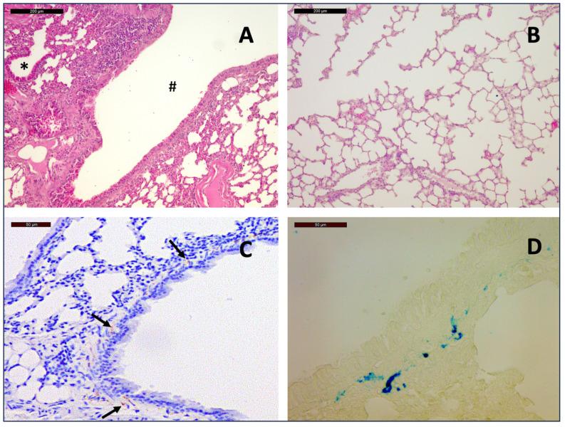 https://cdn.ncbi.nlm.nih.gov/pmc/blobs/8453/12024158/e49ba0e5cd25/arm-93-00007-g001.jpg