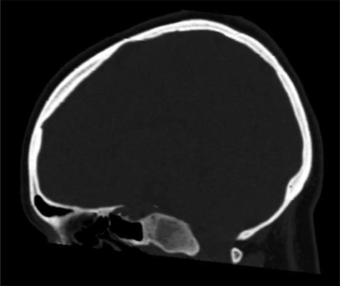 https://cdn.ncbi.nlm.nih.gov/pmc/blobs/8454/7708769/a1c73f357377/gr4.jpg