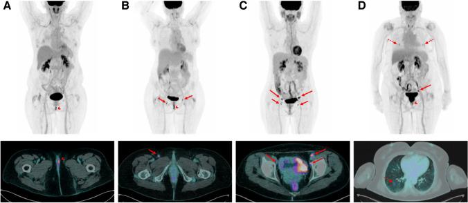 https://cdn.ncbi.nlm.nih.gov/pmc/blobs/8457/11300493/583247c14982/259_2024_6604_Fig3_HTML.jpg