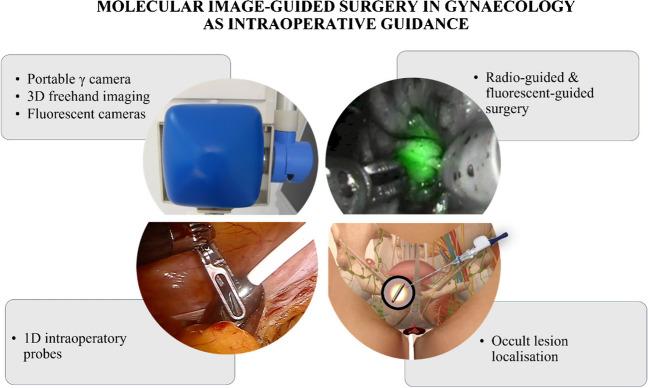 https://cdn.ncbi.nlm.nih.gov/pmc/blobs/8457/11300493/bddef0615f13/259_2024_6604_Fig2_HTML.jpg