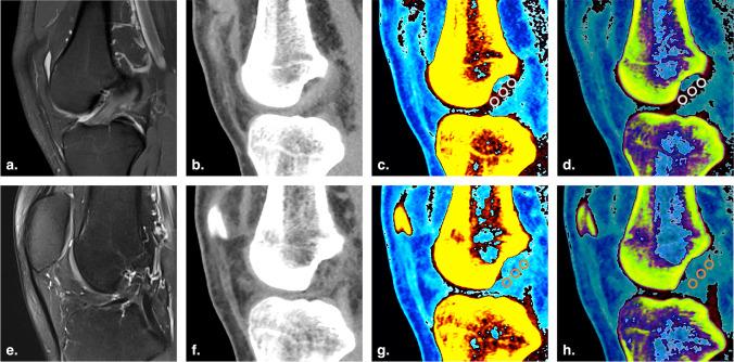 https://cdn.ncbi.nlm.nih.gov/pmc/blobs/845a/10598075/d640a289c78a/330_2023_9720_Fig3_HTML.jpg