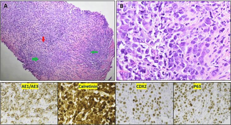 https://cdn.ncbi.nlm.nih.gov/pmc/blobs/845b/8301270/21ae45334c4d/cureus-0013-00000015831-i04.jpg