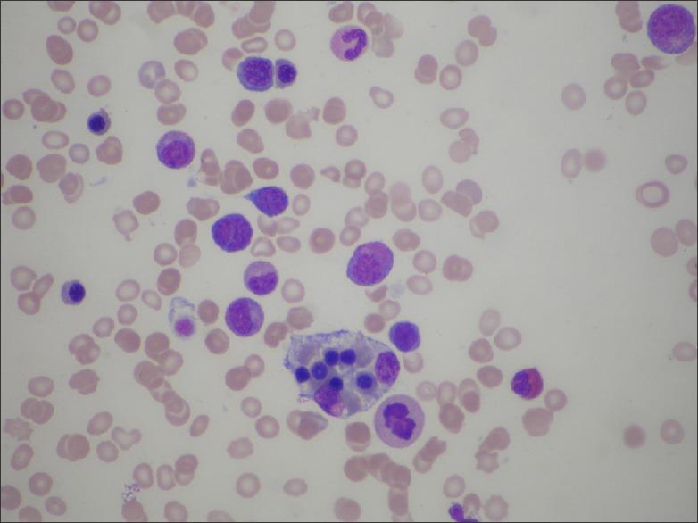 https://cdn.ncbi.nlm.nih.gov/pmc/blobs/845c/4533575/0e1f99e13624/IJD-60-422e-g004.jpg