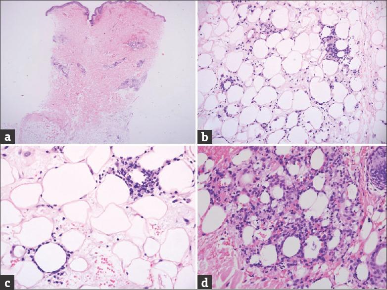 https://cdn.ncbi.nlm.nih.gov/pmc/blobs/845c/4533575/cb5a21bfec16/IJD-60-422e-g002.jpg