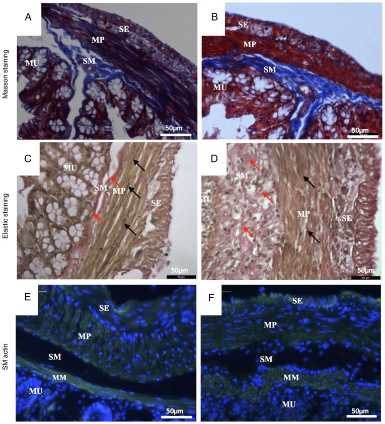 https://cdn.ncbi.nlm.nih.gov/pmc/blobs/8462/7401218/76631ab262ba/etm-20-03-1987-g02.jpg
