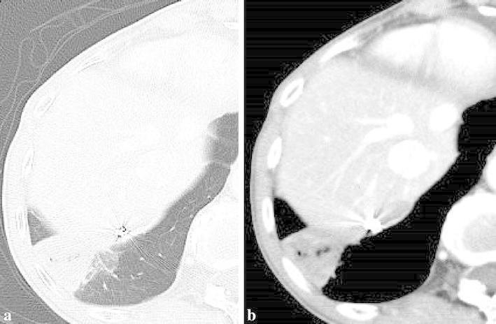 https://cdn.ncbi.nlm.nih.gov/pmc/blobs/8469/4536247/634686e392ea/40064_2015_1219_Fig5_HTML.jpg