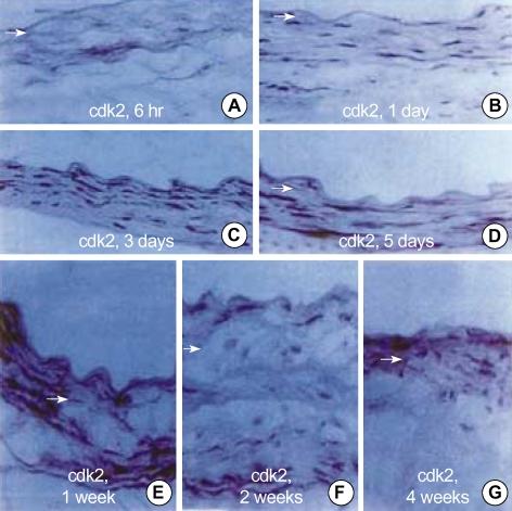 https://cdn.ncbi.nlm.nih.gov/pmc/blobs/846b/2816830/2d14f82c35a1/jkms-19-327-g003.jpg