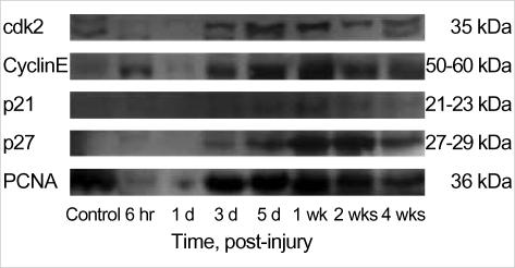 https://cdn.ncbi.nlm.nih.gov/pmc/blobs/846b/2816830/ac33fec5d420/jkms-19-327-g002.jpg
