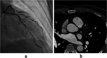 https://cdn.ncbi.nlm.nih.gov/pmc/blobs/8472/4430913/5ae3b4dc191b/13019_2015_249_Fig1_HTML.jpg