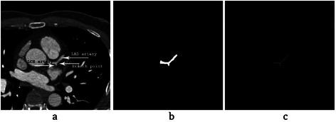 https://cdn.ncbi.nlm.nih.gov/pmc/blobs/8472/4430913/5c55b2dfdb1d/13019_2015_249_Fig19_HTML.jpg