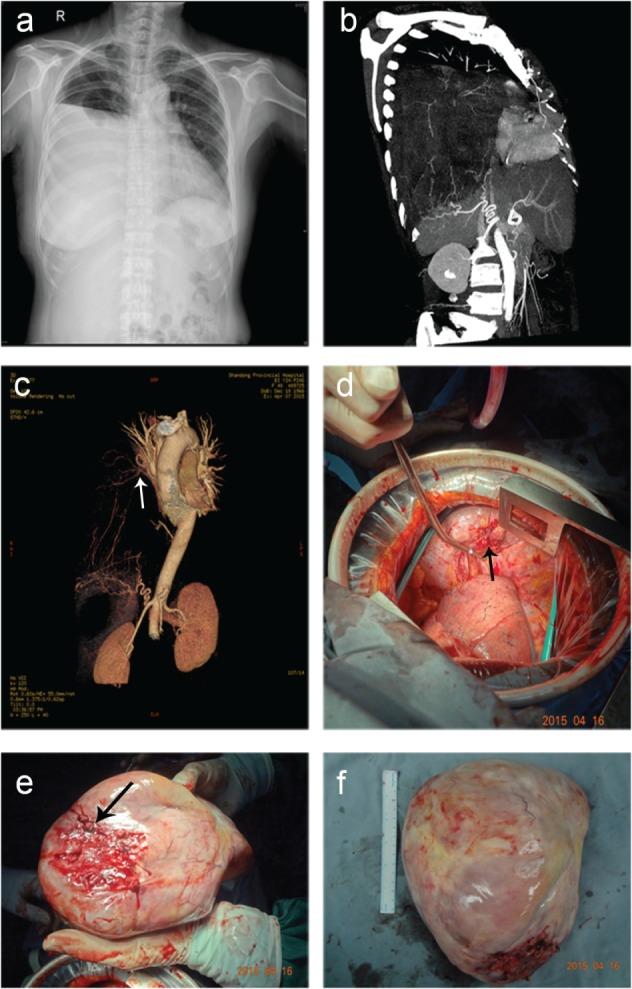 https://cdn.ncbi.nlm.nih.gov/pmc/blobs/8473/5582482/427d4745ab5d/TCA-8-402-g004.jpg