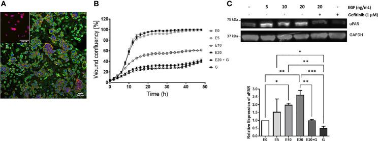 https://cdn.ncbi.nlm.nih.gov/pmc/blobs/8475/9035872/cf36d023f75b/fonc-12-835929-g006.jpg