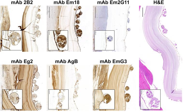 https://cdn.ncbi.nlm.nih.gov/pmc/blobs/8479/10061086/d7ae3145a44f/fcimb-13-1162530-g002.jpg