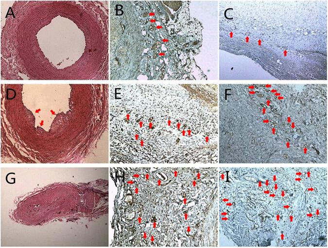 https://cdn.ncbi.nlm.nih.gov/pmc/blobs/847a/5539241/91cc16def99a/41598_2017_6127_Fig5_HTML.jpg