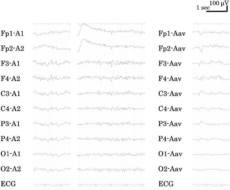 https://cdn.ncbi.nlm.nih.gov/pmc/blobs/847b/4589839/55e80765b243/gr3.jpg