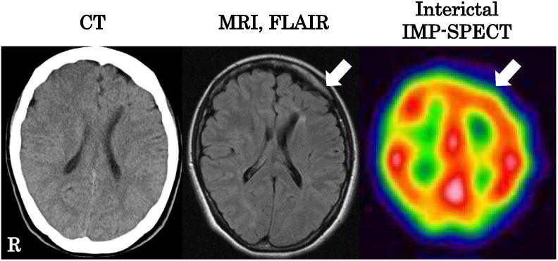 https://cdn.ncbi.nlm.nih.gov/pmc/blobs/847b/4589839/d2b08ab51a71/gr4.jpg