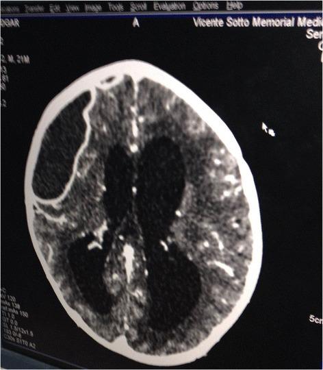 https://cdn.ncbi.nlm.nih.gov/pmc/blobs/847b/5329920/1c29ef0c66b6/40696_2015_3_Fig1_HTML.jpg
