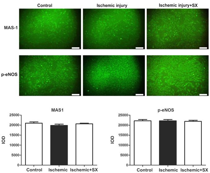 https://cdn.ncbi.nlm.nih.gov/pmc/blobs/8484/5639384/273fdcc1d1a5/etm-14-04-3523-g06.jpg