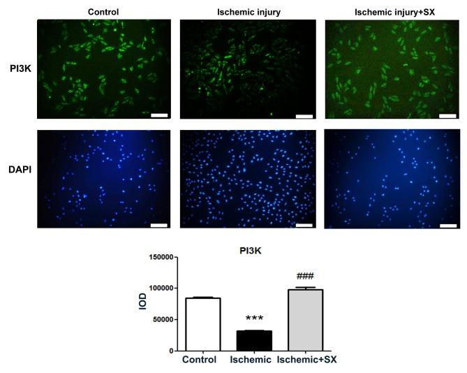 https://cdn.ncbi.nlm.nih.gov/pmc/blobs/8484/5639384/fe8e2d1f4085/etm-14-04-3523-g05.jpg