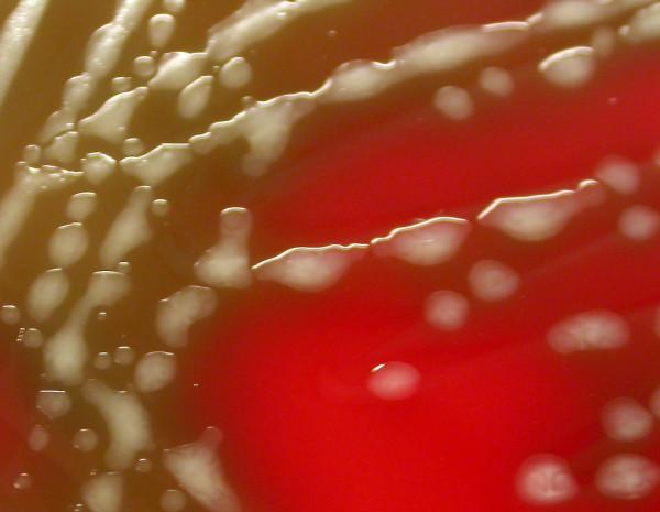 https://cdn.ncbi.nlm.nih.gov/pmc/blobs/8486/2921389/4bd0b5c8a402/1471-2334-10-233-2.jpg