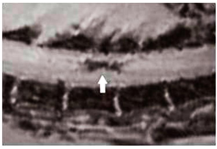 https://cdn.ncbi.nlm.nih.gov/pmc/blobs/8493/3741606/0c65caf7f8a3/thnov03p0573g05.jpg