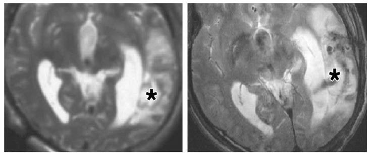https://cdn.ncbi.nlm.nih.gov/pmc/blobs/8493/3741606/569d5089b901/thnov03p0573g08.jpg
