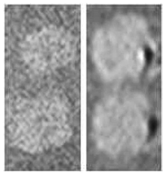 https://cdn.ncbi.nlm.nih.gov/pmc/blobs/8493/3741606/92ca421a296c/thnov03p0573g07.jpg
