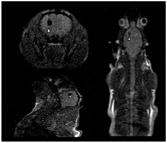 https://cdn.ncbi.nlm.nih.gov/pmc/blobs/8493/3741606/d3f6579f1c6e/thnov03p0573g04.jpg