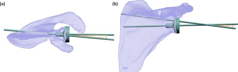 https://cdn.ncbi.nlm.nih.gov/pmc/blobs/84a2/11564314/58481def7aa0/264_2024_6340_Fig4_HTML.jpg