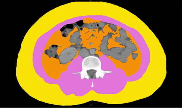 https://cdn.ncbi.nlm.nih.gov/pmc/blobs/84a3/8895760/4d13ccd42c35/12885_2022_9312_Fig1_HTML.jpg