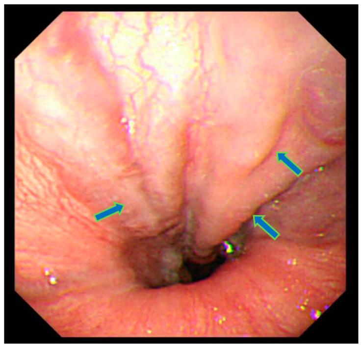 https://cdn.ncbi.nlm.nih.gov/pmc/blobs/84bf/11507581/72616dd7bdef/diseases-12-00251-g001.jpg