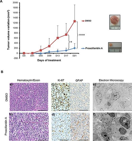 https://cdn.ncbi.nlm.nih.gov/pmc/blobs/84c0/4279420/6065cdd880af/oncotarget-05-10934-g005.jpg