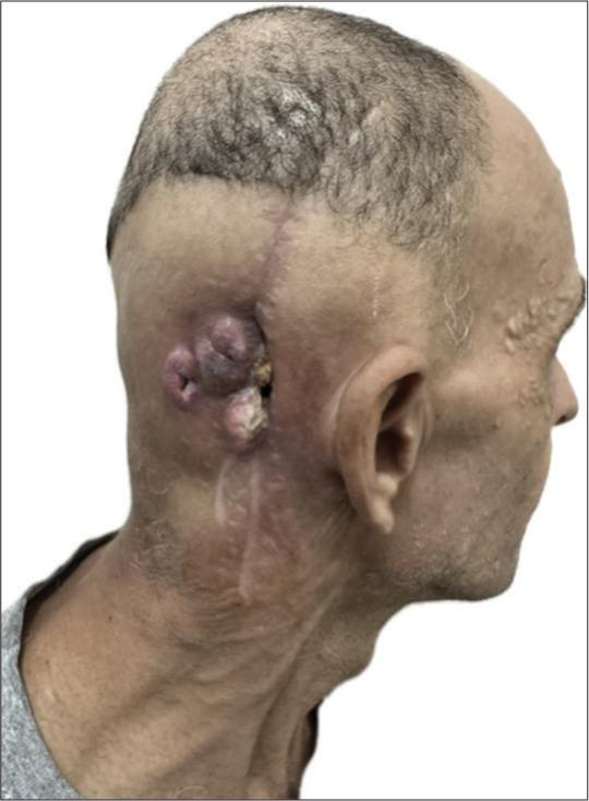 https://cdn.ncbi.nlm.nih.gov/pmc/blobs/84c3/11021098/f48e3ef6f06f/SNI-15-89-g007.jpg